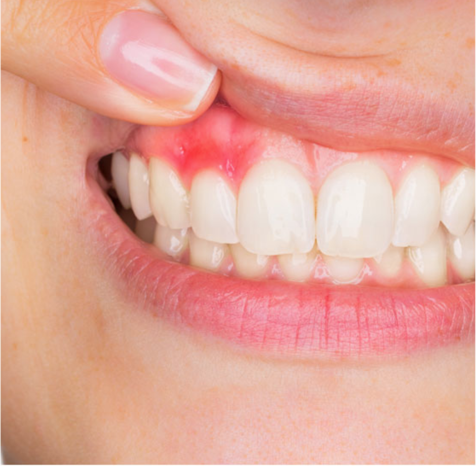 Emergency Dentist Rotherham Precision Dental, Cosmetic & Implant Clinic