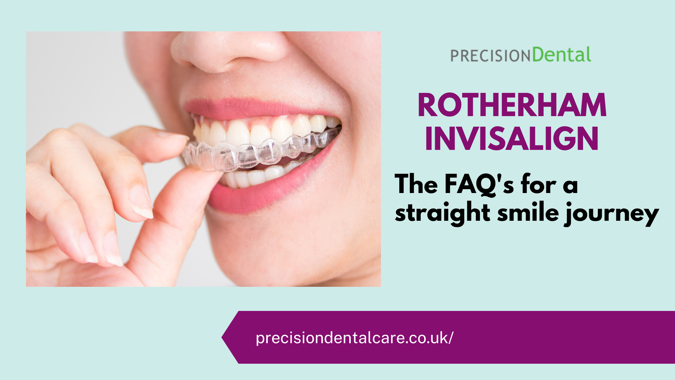 Invisible Braces: Types, How They Work & Cost (Want a Straight Smile?)